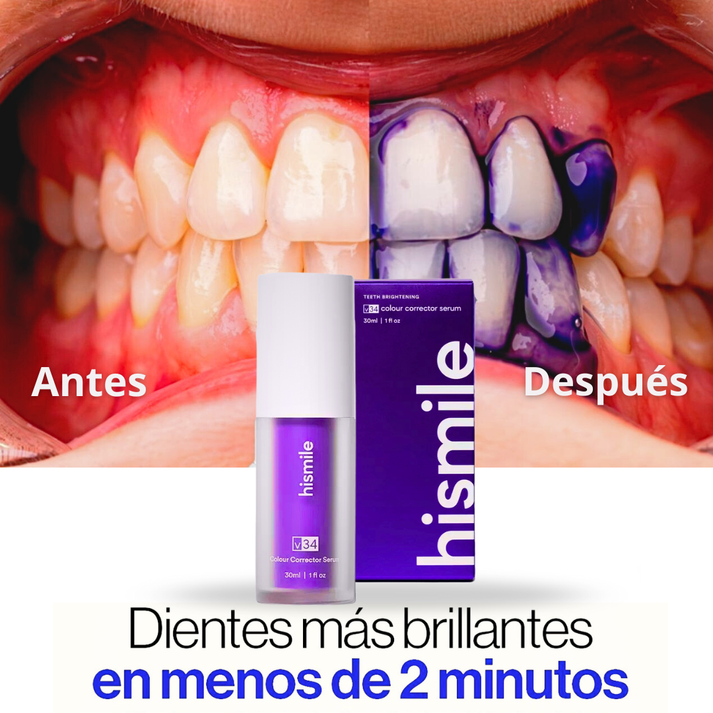 Blanqueador Dental V34™ – ¡Dientes más blancos al instante!