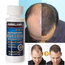 Minoxidil Kirkland 60ml