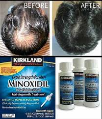 Minoxidil Kirkland 60ml
